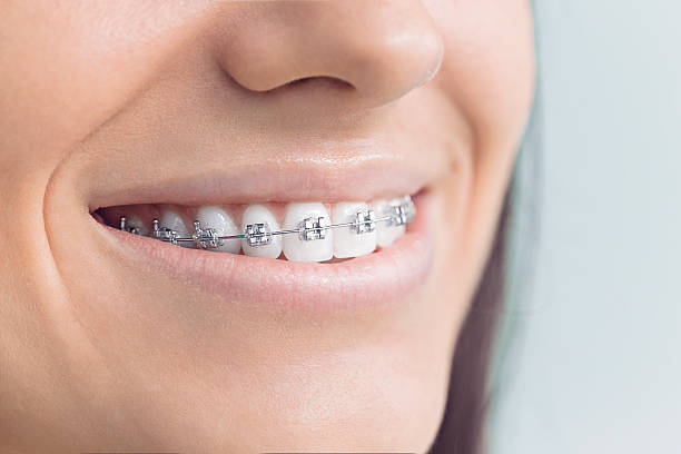 Trusted Mcfarland, CA  Holistic Dental Services Experts